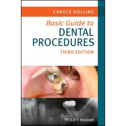 Basic Guide to Dental Procedures