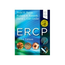 ERCP