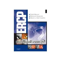 ERCP