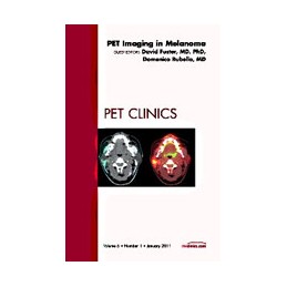 Pet Imaging in Melanoma, An...