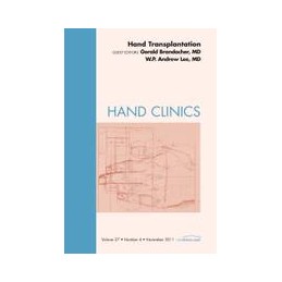 Hand Transplantation, An...