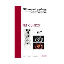 PET Imaging of Lymphoma, An...