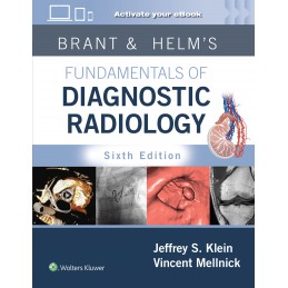 Brant & Helm's Fundamentals...