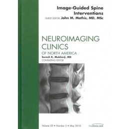 Image-Guided Spine...