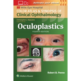 Oculoplastics