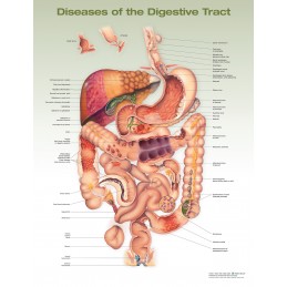 Diseases of the Digestive Tract Anatomical Chart