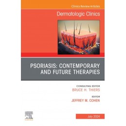 Psoriasis: Contemporary and Future Therapies, An Issue of Dermatologic Clinics