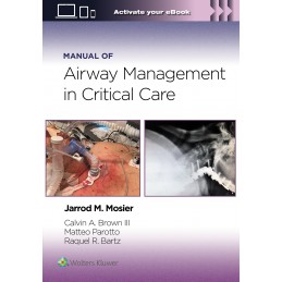 Manual of Airway Management in Critical Care: Print + digital version with Multimedia