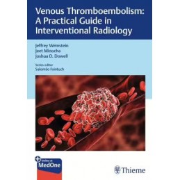 Venous Thromboembolism: A Practical Guide in Interventional Radiology