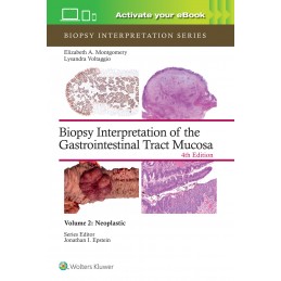 Biopsy Interpretation of the Gastrointestinal Tract Mucosa Volume 2: Neoplastic: Print + digital version with Multimedia