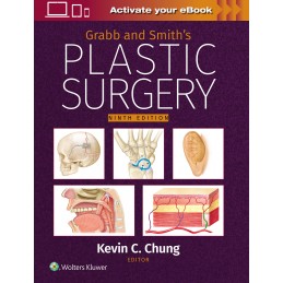 Grabb and Smith's Plastic Surgery: Print + digital version with Multimedia