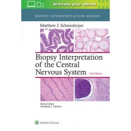 Biopsy Interpretation of the Central Nervous System