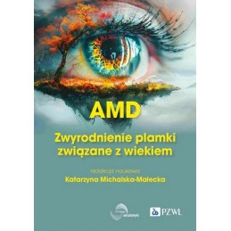 AMD Zwyrodnienie plamki żółtej związane z wiekiem