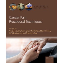 Cancer Pain Procedural...