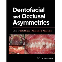 Dentofacial and Occlusal Asymmetries