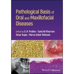 Pathological Basis of Oral and Maxillofacial Diseases