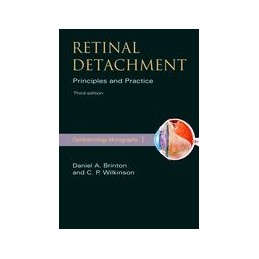 Retinal Detachment