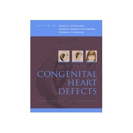 Congenital Heart Defects