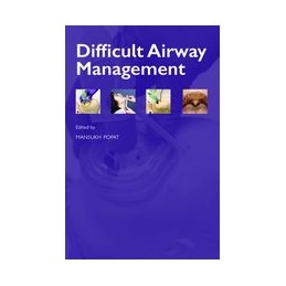 Difficult Airway Management