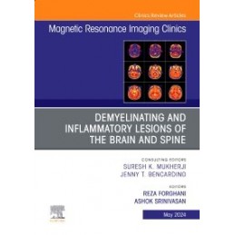 Demyelinating and Inflammatory Lesions of the Brain and Spine, An Issue of Magnetic Resonance Imaging Clinics of North America