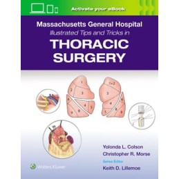 Massachusetts General Hospital Illustrated Tips and Tricks in Thoracic Surgery: Print + digital version with Multimedia