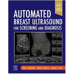 Automated Breast Ultrasound for Screening and Diagnosis