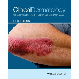 Clinical Dermatology