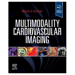 Multimodality Cardiovascular Imaging