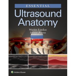 Essential Ultrasound Anatomy