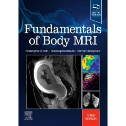 Fundamentals of Body MRI