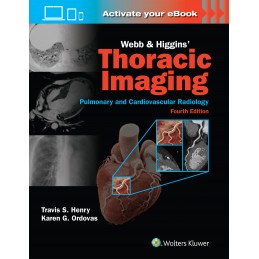 Webb & Higgins Thoracic Imaging: Print + digital version with Multimedia