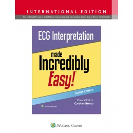 ECG Interpretation Made Incredibly Easy!