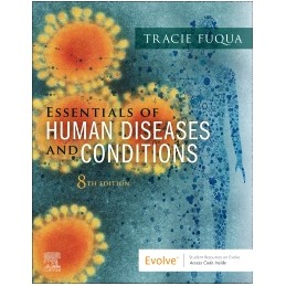 Essentials of Human Diseases and Conditions