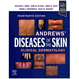 Andrews' Diseases of the Skin