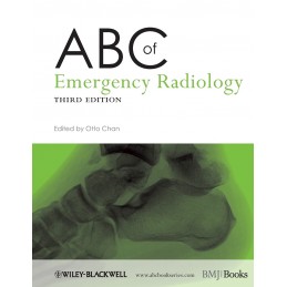 ABC of Emergency Radiology