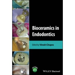 Bioceramics in Endodontics