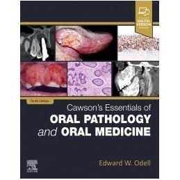 Cawson's Essentials of Oral Pathology and Oral Medicine