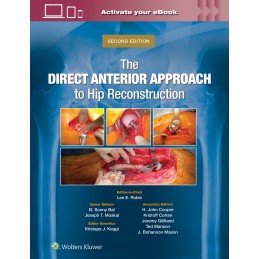 The Direct Anterior...