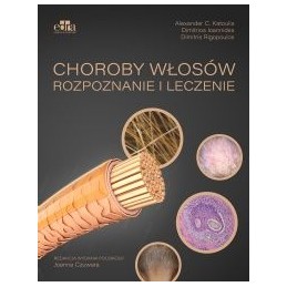 Choroby włosów. Rozpoznanie...