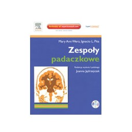 Zespoły padaczkowe