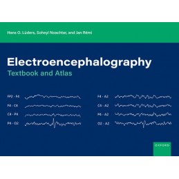 Electroencephalography