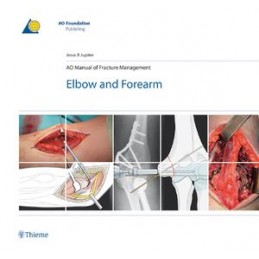 AO Manual of Fracture...