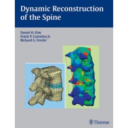 Dynamic Reconstruction of the Spine