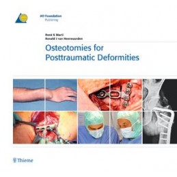 Osteotomies for Posttraumatic Deformities