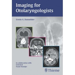 Imaging for Otolaryngologists