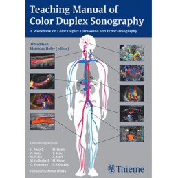 Teaching Manual of Color Duplex Sonography