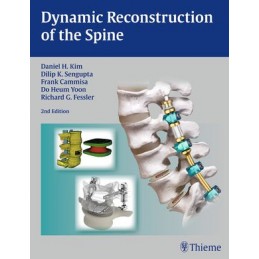 Dynamic Reconstruction of the Spine