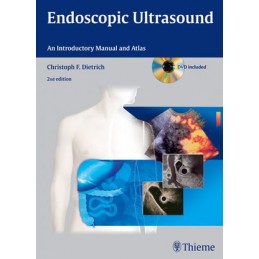 Endoscopic Ultrasound: An Introductory Manual and Atlas