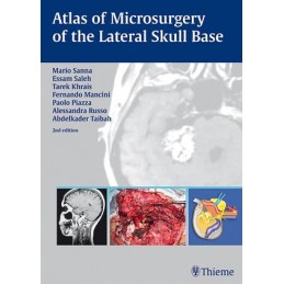 Atlas of Microsurgery of the Lateral Skull Base