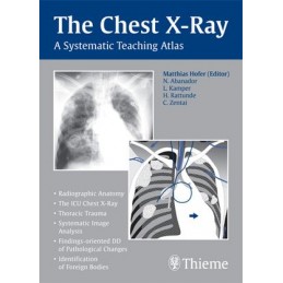 The Chest X-Ray: A Systematic Teaching Atlas